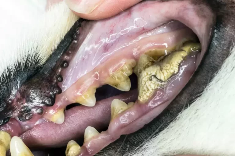 limpieza dental
